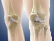 ARTHROSE: hydrogel intelligent pour régénérer cartilage abîmé Santé Orthopédique