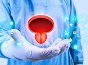 GREFFE VESSIE C’est presque pour demain