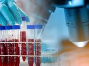 ALZHEIMER test sanguin pour demain