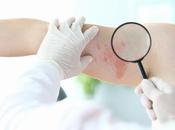 MALADIES PEAU Elles aussi leurs cicatrices cachées