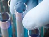 Après avoir senti poisson toute vie, diagnostique rare désordre génétique