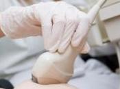 Cancer sein nouvelle protéine responsable progression identifiée