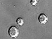 levures pour étudier maladies neurodégénératives