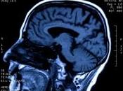 L''imagerie médicale pour comprendre maladies cerveau