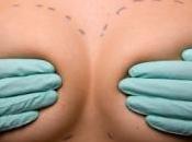 Pour recruter infirmières, clinique tchèque offre nouveaux seins