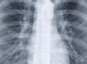 fumée cigarette touche chaque personne même façon