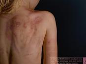 jour silencieux [Abus]