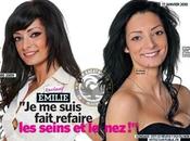 Emilie (Secret Story s'est faite refaire seins