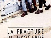 fracture myocarde