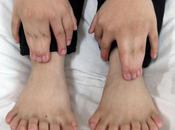 doigts orteils… c’est pied