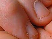 Soigner Petites peaux autour ongles