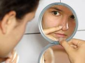 Causes symptômes acnés