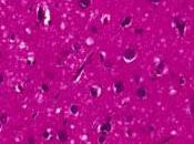 Climat, grandes peurs douloureuse