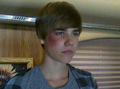 Justin Bieber Hospitalisé d'urgence