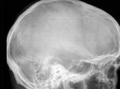 Autopsie d'un accident grave plusieurs victimes