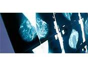 Relecture mammographies numérisées