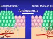 CANCER maladies ophtalmiques: nouvelle biothérapie bloque l’angiogenèse Journal Experimental Medicine