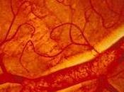 Occlusion rétine CÉCITÉ: globules rouges trop collants Inserm- Journal Thrombosis Haemostasis