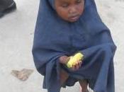 Somalie mort guette enfants atteints malnutrition