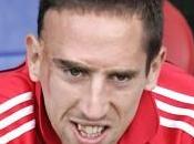 Ribéry Cette cicatrice, elle forgé