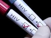 VIH: maladies devraient inciter dépistage Europe Initiative