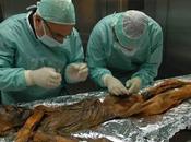 Ötzi aurait souffert maladie Lyme