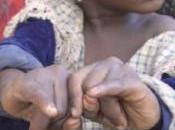 POLIO: Vaccination case millions d’enfants africains Unicef