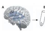 CERVEAU: Découverte nouvelles cellules souches réparatrices PLoS