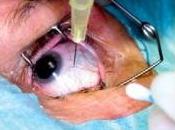 MYOPIE ASIE: Travailler perdre vision Lancet