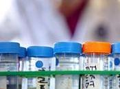 CANCER PROSTATE: Vers test sanguin prédictif risque récidive American Journal Pathology