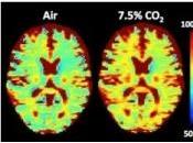 FONCTION CÉRÉBRALE: L’acidité cerveau révélatrice troubles psychiatriques PNAS