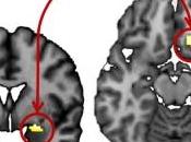 NEURO: Comment l’anxiété peut rester ancrée jamais Journal Neuroscience