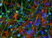 Maladies NEUROLOGIQUES: cellules souches muscle transformables neurones Experimental Cell Research Stem