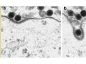 CANCERS: Casser protéine pour noyauter tumeur FEBS Letters