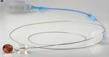 CANCER l’OESOPHAGE: caméra-pilule pourrait reléguer l’endoscopie Nature Medicine