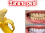 Peau banane pour dents blanches