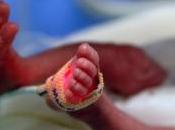 GROSSESSE: Plus pollution élevée, plus faible poids naissance bébé Environmental Health Perspectives