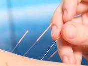 L’acupuncture pour soulager allergies