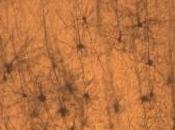 TRISOMIE Découverte d'une protéine cible pour restaurer fonctions cognitives Nature Medicine