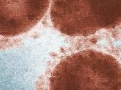 CORONAVIRUS MERS-NCoV: France touchée premier décès Ministère-OMS