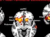 AUTISME: prive parole humaine, d'émotion récompense PNAS