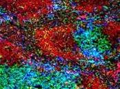 Maladies AUTO-IMMUNES: Découverte molécules clés l'immunité Nature Immunology