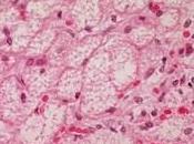 Nouvelle recherche: Comment avoir plus graisses brunes brûler calories repos