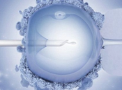premier bébé d’une avec séquençage complet génome