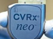 HYPERTENSION: pacemaker pour traiter l'HTA résistante Réseau