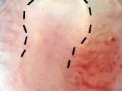 CELLULES SOUCHES: nouvelles dents avec l'urine? Cell Regeneration