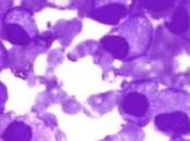 MYÉLOME: mutation favorise survie globules blancs Nature Genetics
