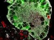 VACCIN anti-VIH: nouveau vers l'espoir Nature