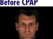 SOMMEIL rend objectivement plus beau Journal Clinical Sleep Medicine