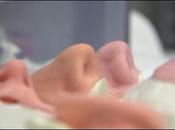 prothèses avec print